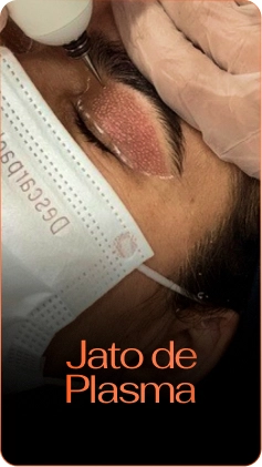 jato de plasma