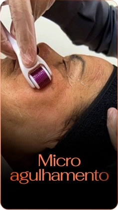 microagulhamento